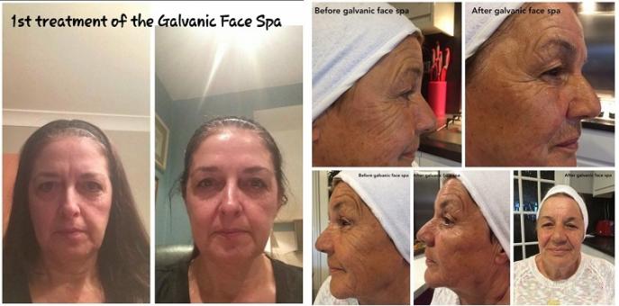  ageLOC Galvanic Spa System II White