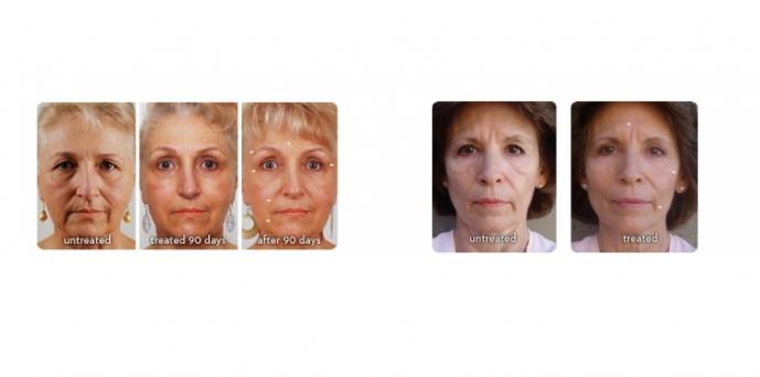  ageLOC Galvanic Spa System II White